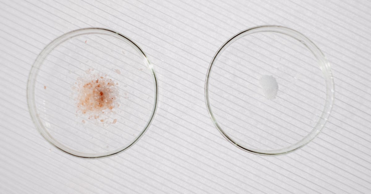 découvrez notre outil de comparaison d'assurances santé pour trouver la couverture idéale qui répond à vos besoins. comparez les offres, économisez sur vos primes et assurez votre bien-être et celui de votre famille.