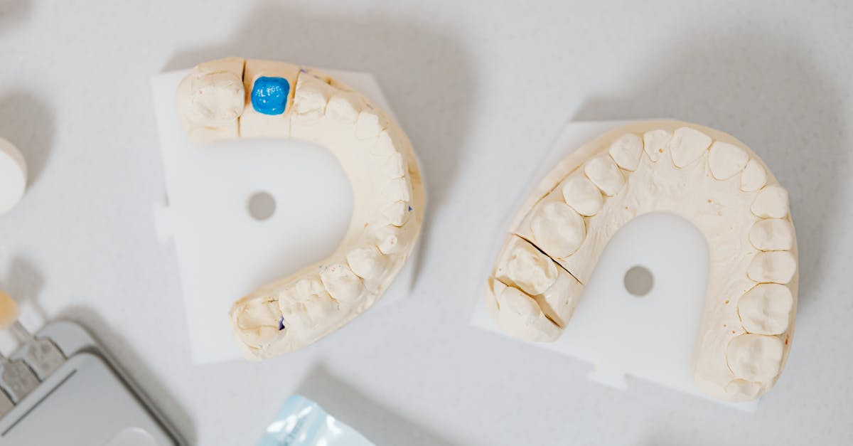 découvrez les derniers traitements en orthodontie pour un sourire parfait. nos experts en orthodontie vous guident à travers les options personnalisées telles que les appareils dentaires et les aligneurs invisibles pour améliorer votre santé bucco-dentaire et votre confiance en vous.