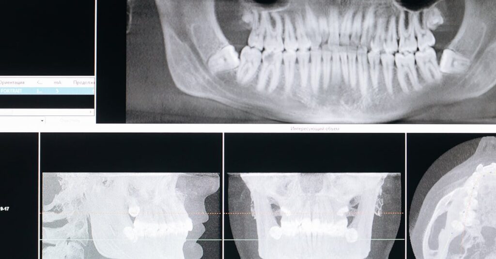 découvrez l'orthodontie, une spécialité dentaire visant à corriger les désalignements des dents et des mâchoires. améliorez votre sourire et votre santé bucco-dentaire grâce à des traitements personnalisés et efficaces, adaptés à tous les âges.